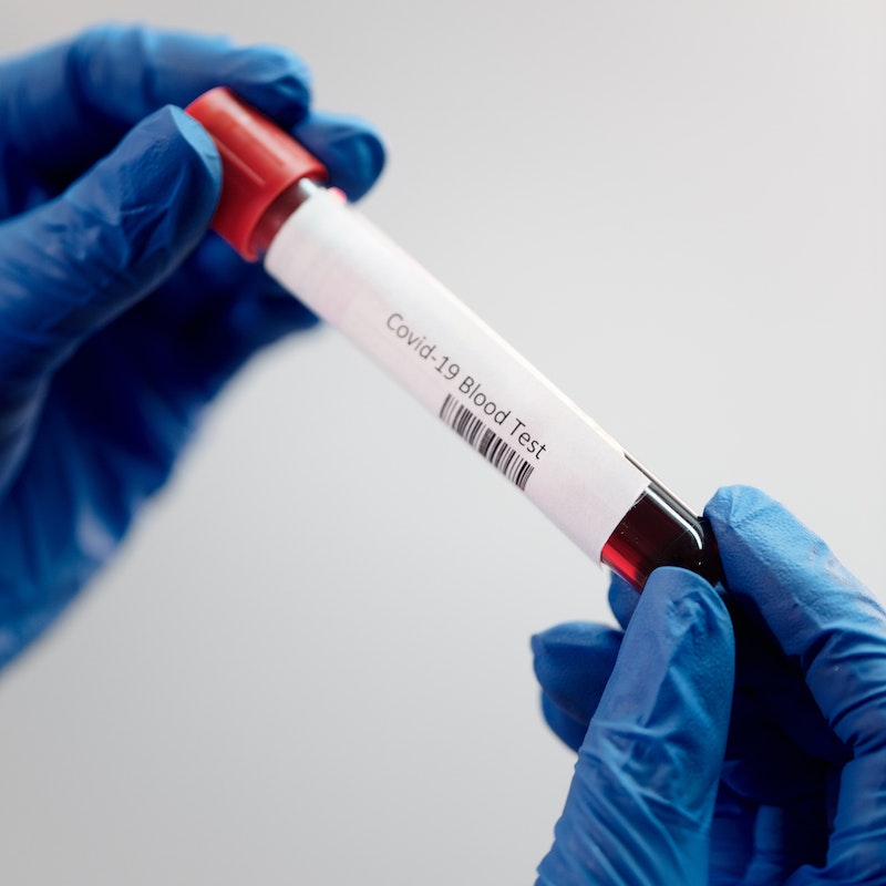 Campionamento del virus