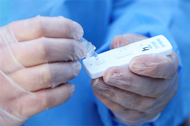 L'autorità di regolamentazione australiana esaminerà l'aumento dei prezzi dei test antigenici COVID-19